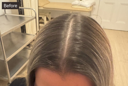Before